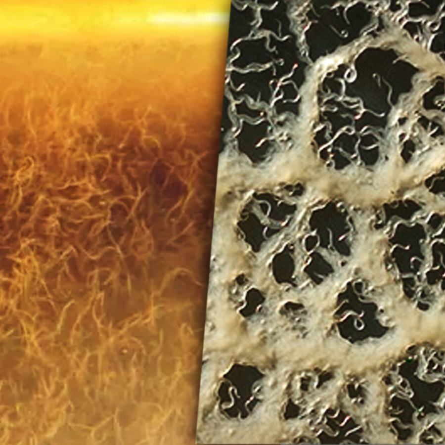 Diferencias entre Microgusano de Avena y Anguililla del Vinagre
